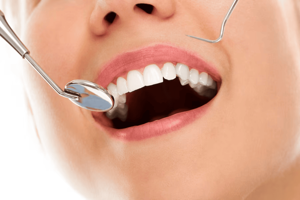 The Ultimate Guide to Professional Teeth Whitening Procedures